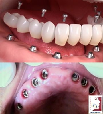Odontologia Especializada Fonseca - Luiz Fernando M Fonseca foto 5